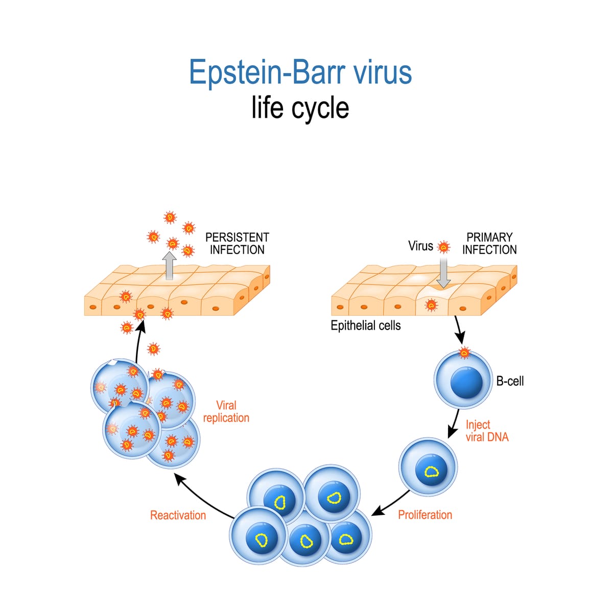 Virus Epstein Barr Et Lupus _ Epstein – NHAJR