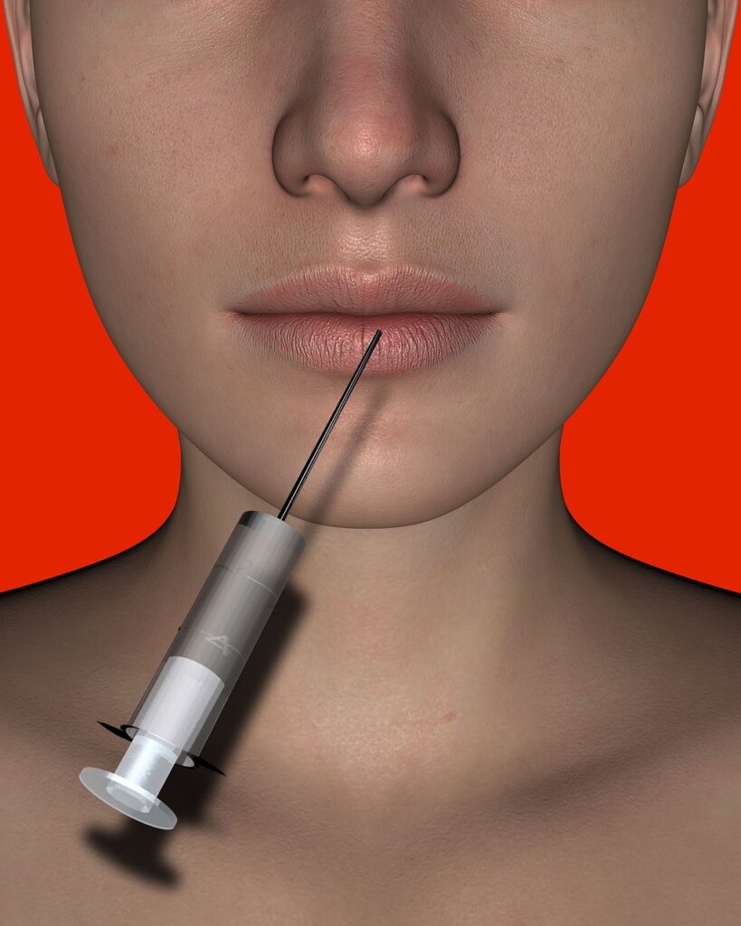 Botox or filler injections for lupus picture of a woman getting a lip injection