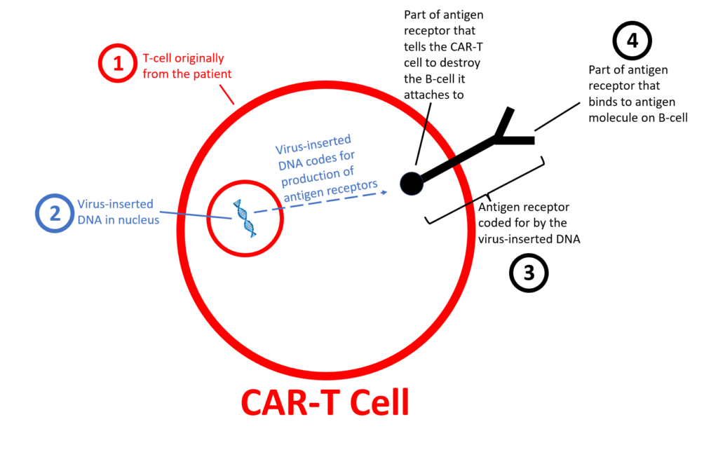 Image of CAR-T cell made simple for lupus patients