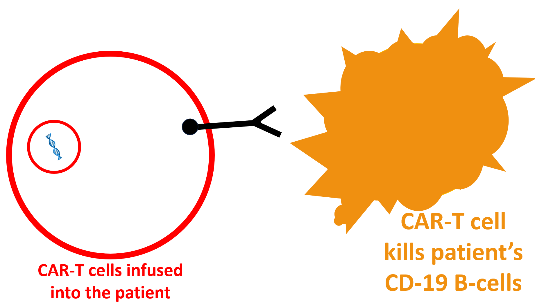 Image of lupus patient's B-cells being destroyed by CAR-T cells