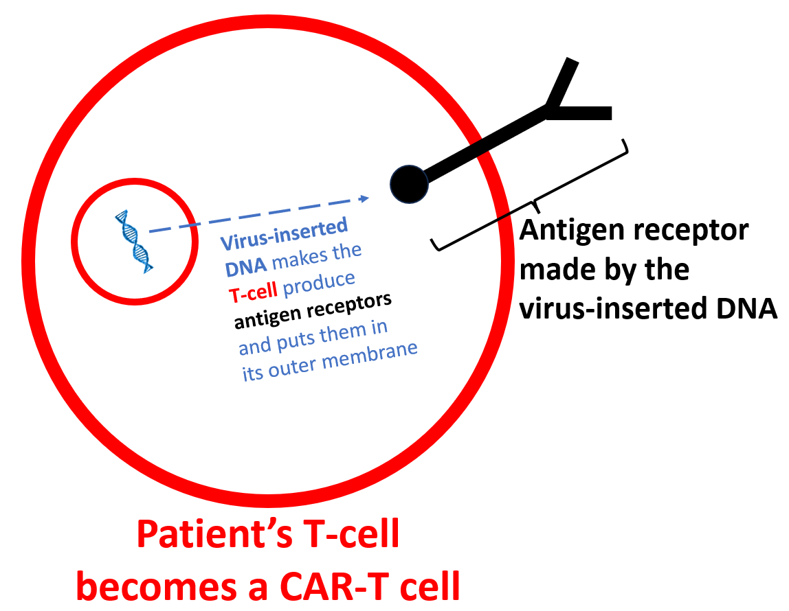 Image of patient's T-cell making an antigen receptor and becomes a CAR-T cell for lupus