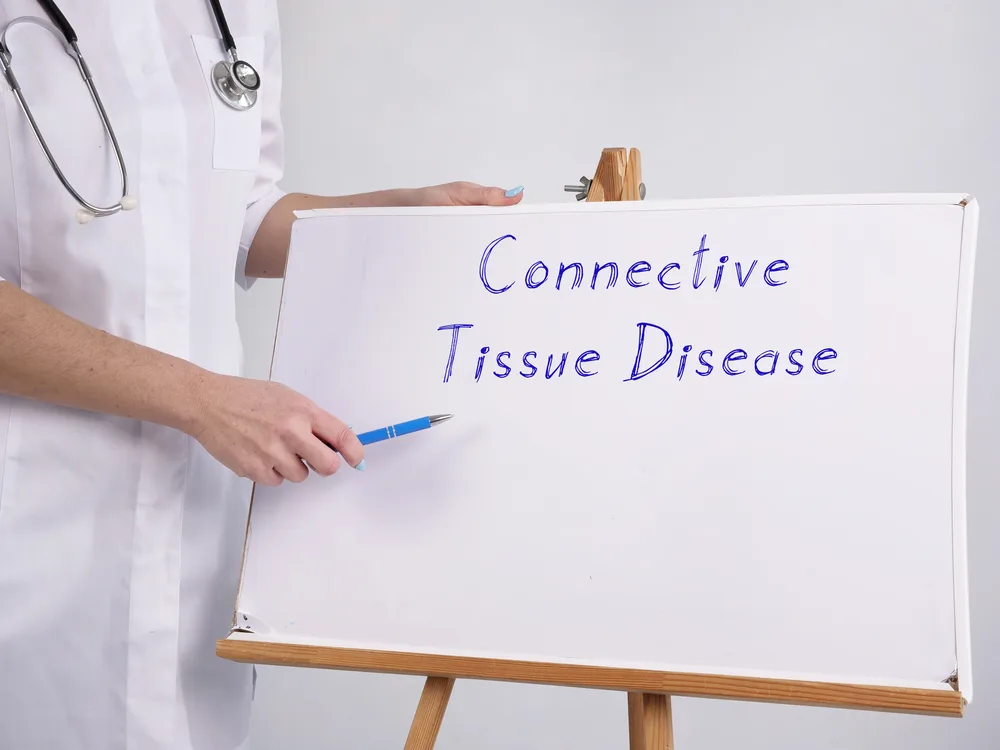 Connective Tissue Disease written on a white board by a doctor