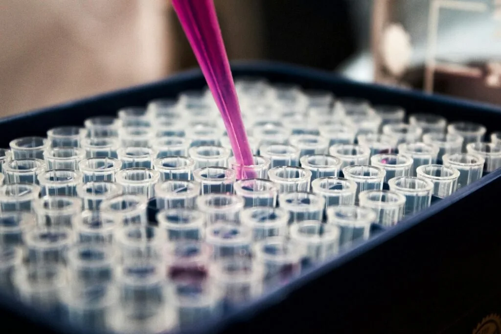 Lupus laboratory tests
