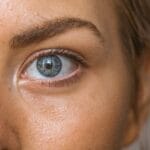 Lupus and Dry Eyes