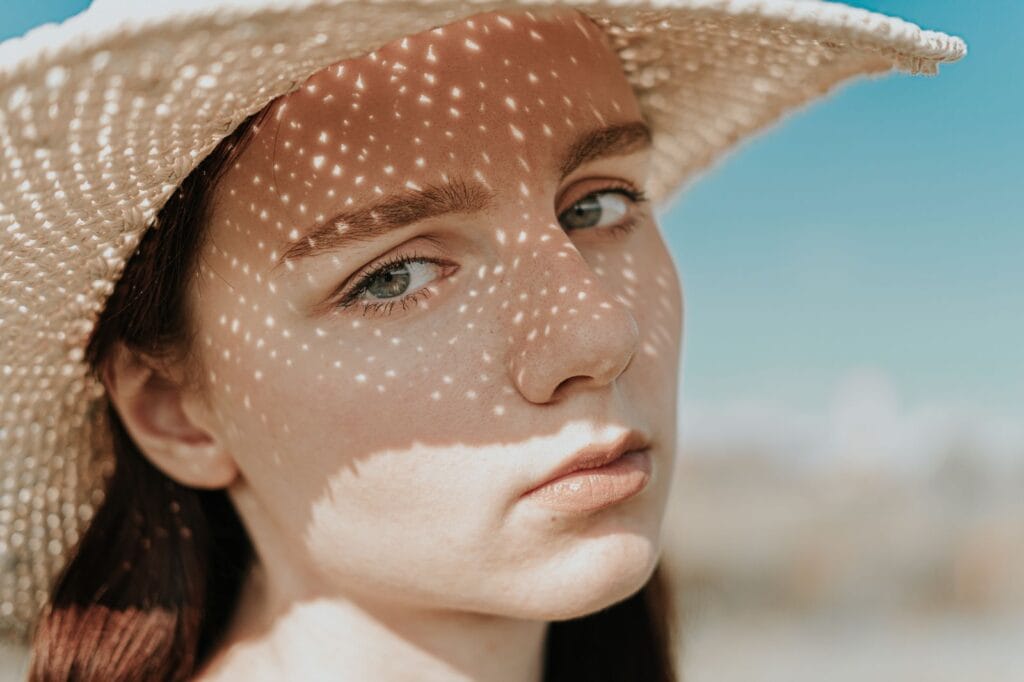 Photosensitivity and lupus. Young woman in straw hat casting intricate shadows on her face under bright sun.