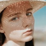 Lupus and Photosensitivity