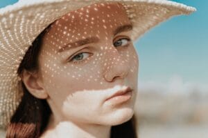 Photosensitivity and lupus. Young woman in straw hat casting intricate shadows on her face under bright sun.