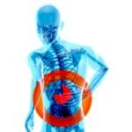 GERD and Peptic Ulcer Disease in Lupus