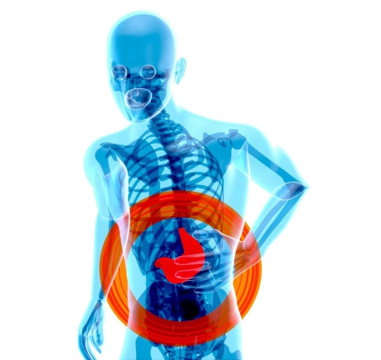 GERD and Peptic Ulcer Disease in Lupus