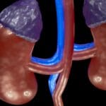 Lupus and Adrenal Insufficiency
